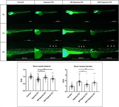 Hyperactivation of Wnt/β-catenin and Jak/Stat3 pathways in human and zebrafish foetal growth restriction models: Implications for pharmacological rescue